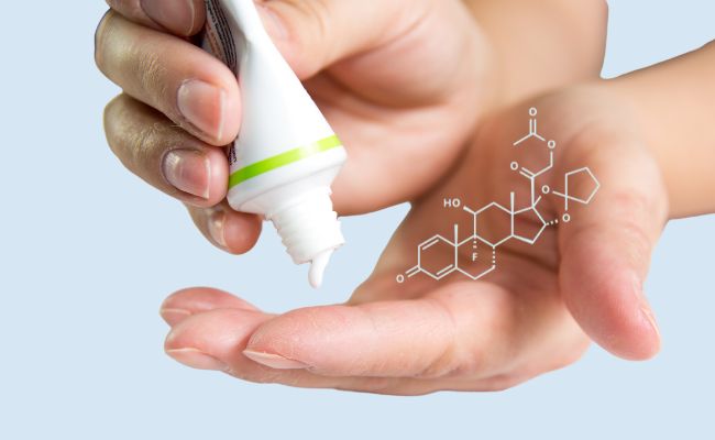 Cách trị mụn dị ứng tại nhà bằng thuốc bôi chứa Corticoid