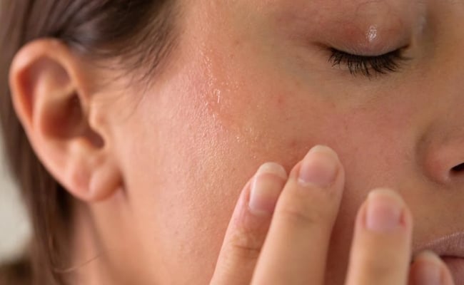 Thế nào là da khô? Da khô là gì?
