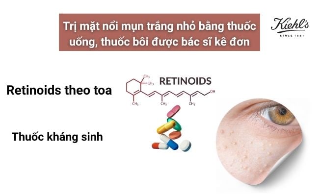 Cách điều trị tình trạng mặt nổi mụn trắng nhỏ
