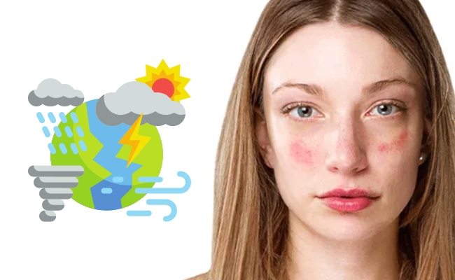 Thời tiết tác động khiến da nhạy cảm