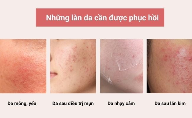 Ai nên dùng serum phục hồi da?