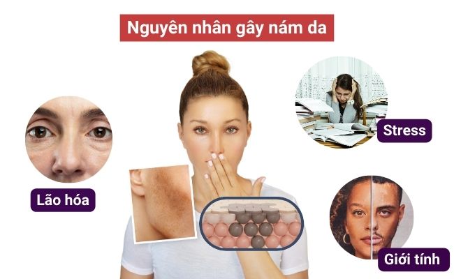 Nguyên nhân gây nám da là gì?