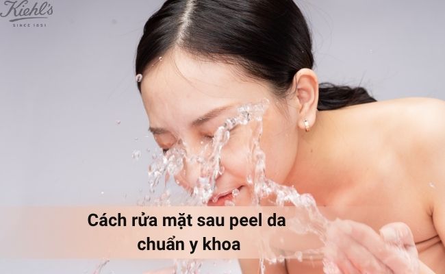 Cách rửa mặt sau peel da chuẩn y khoa