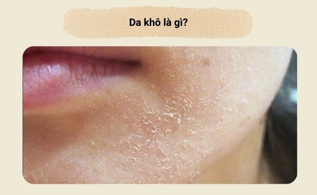 Da khô là gì
