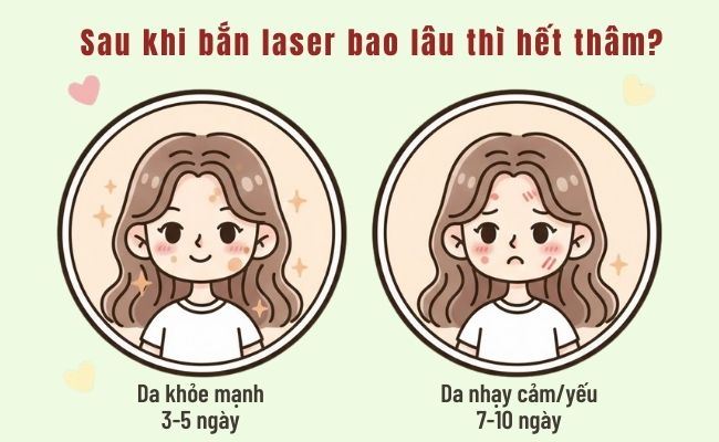 Sau khi bắn laser bao lâu thì hết thâm?