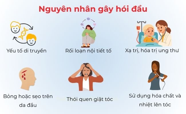 Nguyên nhân gây hói đầu