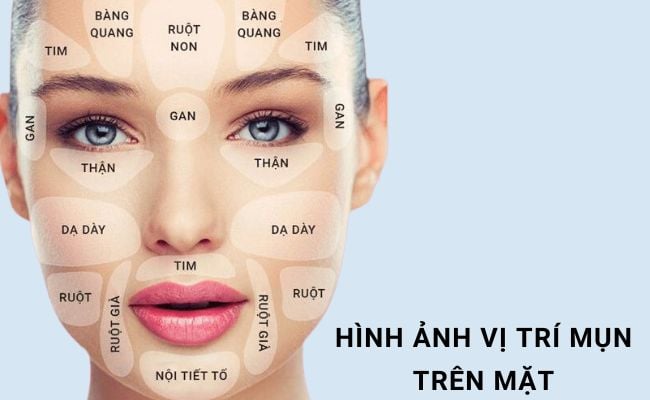 Vị trí mụn trên mặt có ý nghĩa như thế nào?