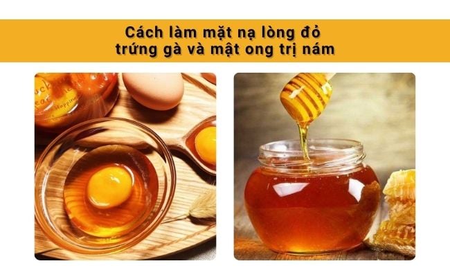 Cách làm mặt nạ lòng đỏ trứng gà và mật ong trị nám