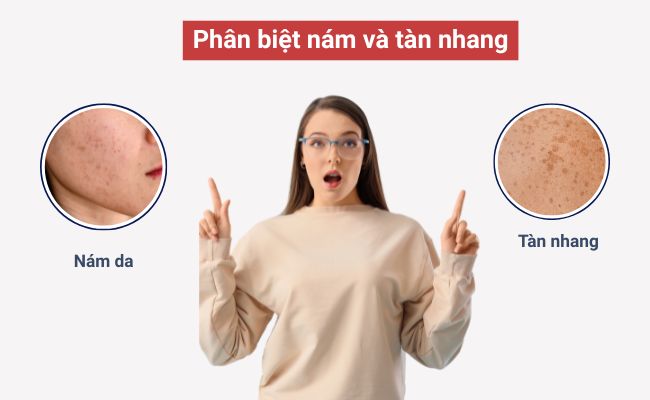 Phân biệt nám da và những bệnh lý khác như thế nào?