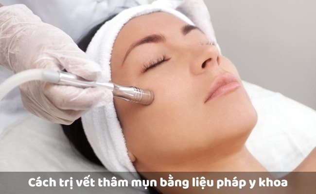 Liệu pháp Y khoa - Cách trị vết thâm mụn mãi không hết

