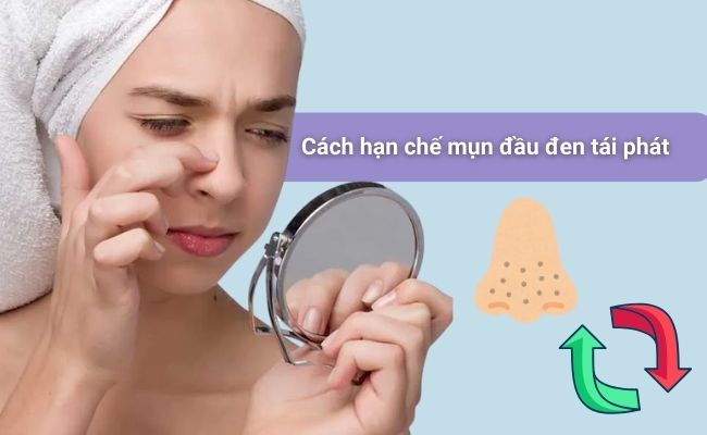 Cách hạn chế mụn đầu đen tái phát