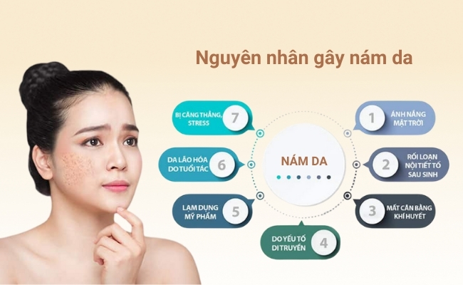 Nguyên nhân hình thành nám trên da