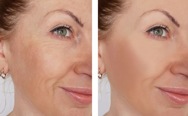 Bakuchiol có tác dụng ngăn ngừa lão hóa