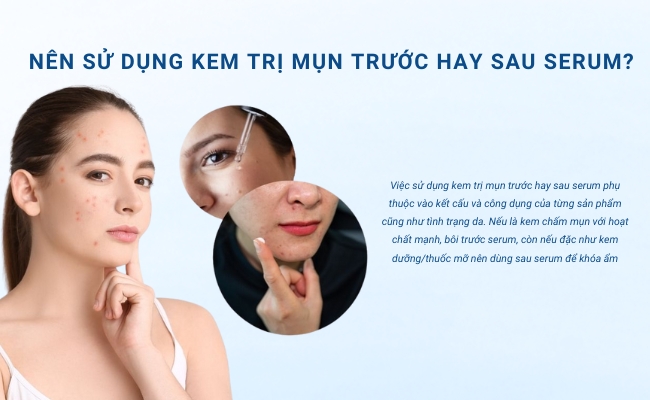 Nên bôi kem trị mụn trước hay sau serum