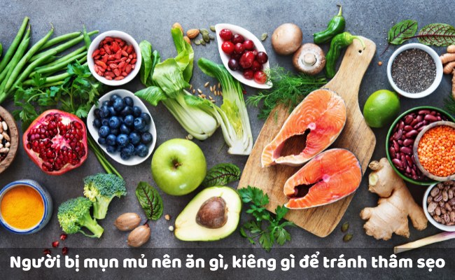 Người bị mụn mủ nên ăn gì, kiêng gì để tránh thâm sẹo