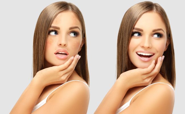 cách chọn retinol cho da khô