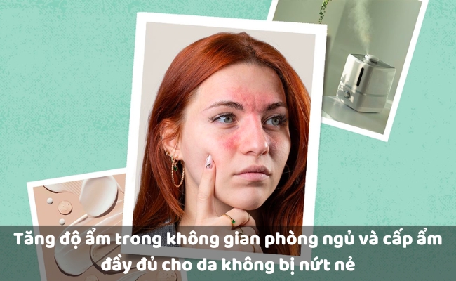 Cách chăm sóc da mùa đông dễ thực hiện, bạn nên biết