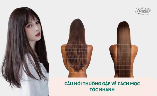 Câu hỏi thường gặp về cách mọc tóc nhanh
