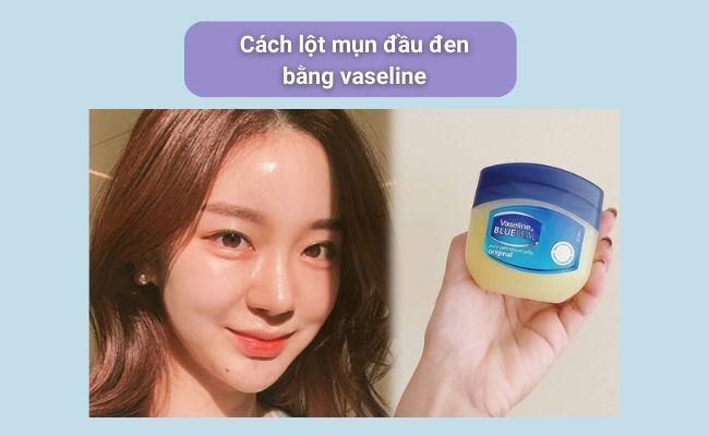 Cách lột mụn đầu đen tại nhà đơn giản, hiệu quả