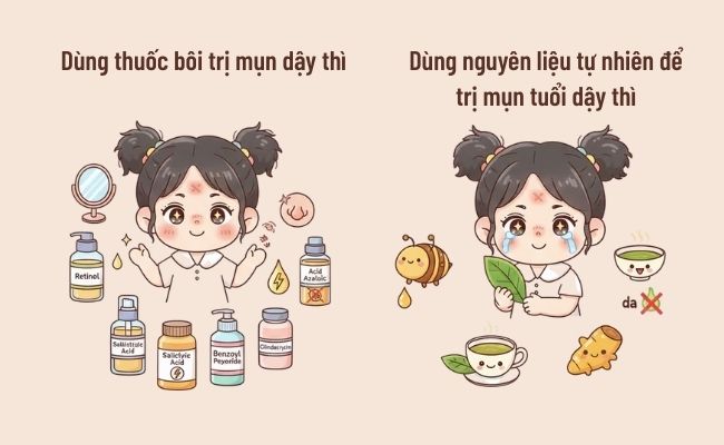Cách cải thiện mụn tuổi dậy thì hiệu quả