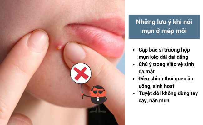 Những lưu ý khi nổi mụn ở mép môi