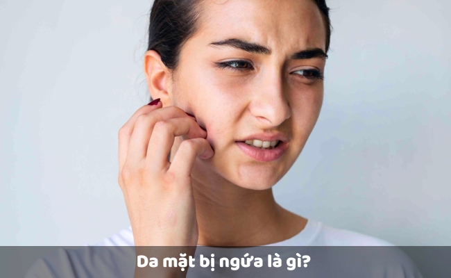 Da mặt bị ngứa là gì? 