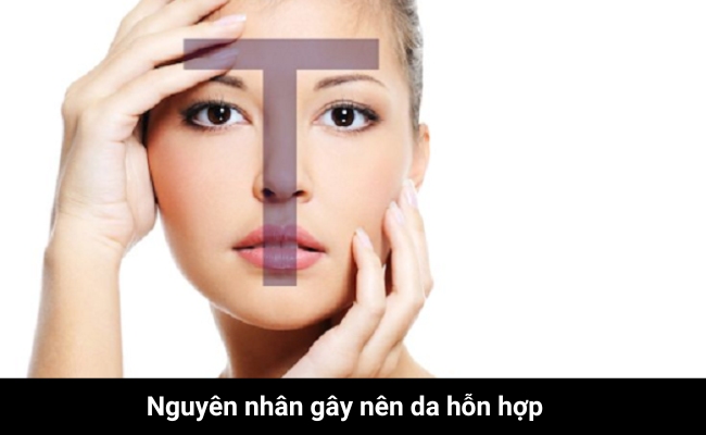 nguyên nhân gây nên da hỗn hợp