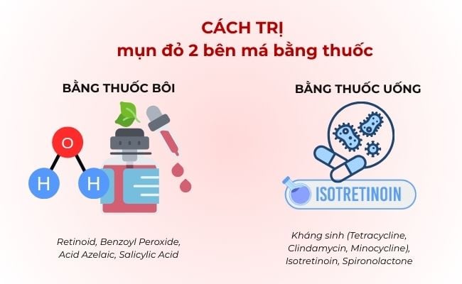 Cách trị mụn đỏ 2 bên má bằng thuốc
