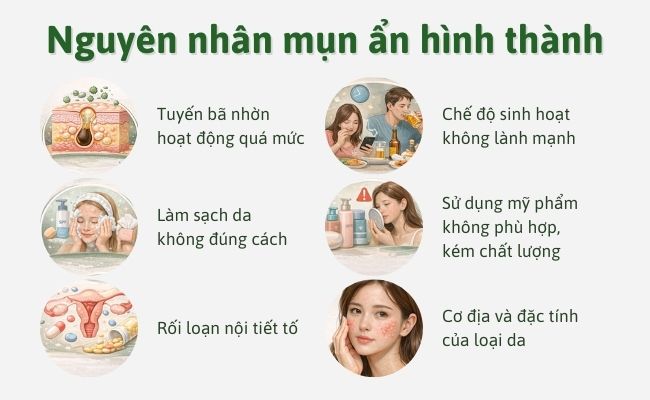 Nguyên nhân mụn ẩn hình thành