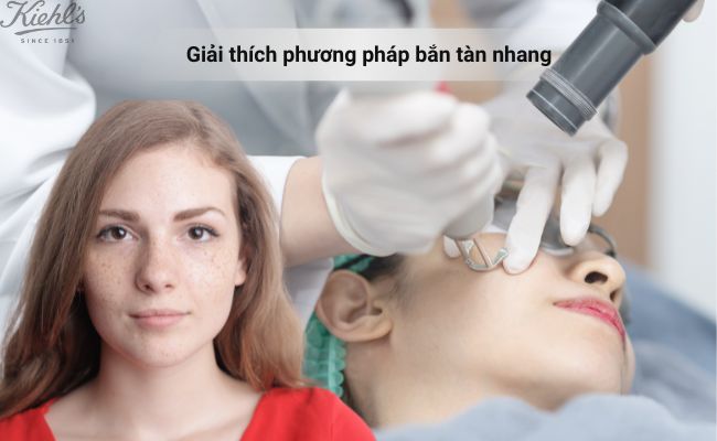 Giải thích phương pháp bắn tàn nhang