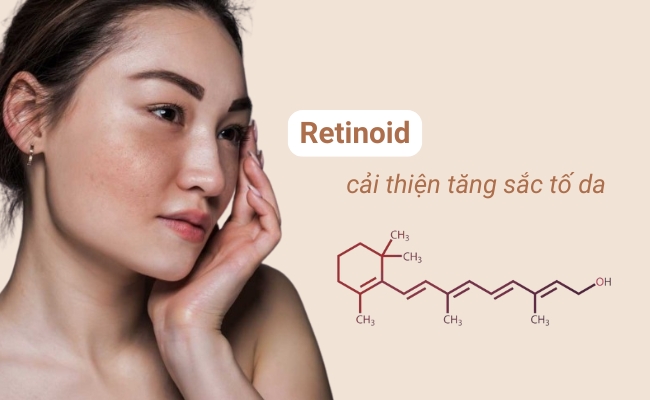 Nên bắt đầu sử dụng Retinoid với nồng độ thấp