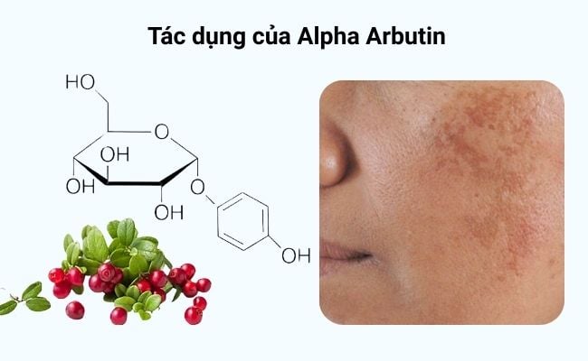 Alpha Arbutin Là Gì? Tác Dụng Làm Sáng Da & Lưu Ý | Kiehl's