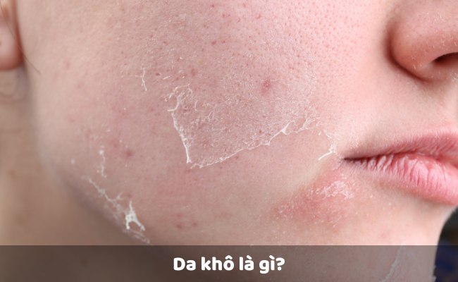Da khô là gì?