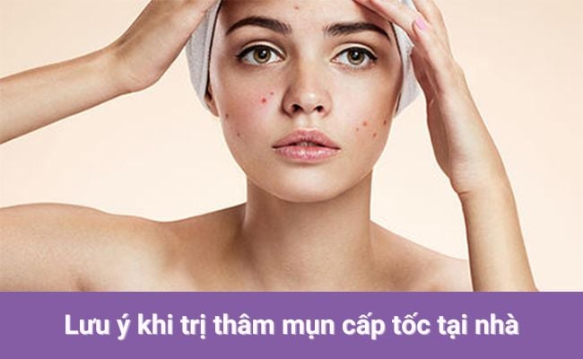 Đánh bay vết thâm mụn nhanh nhất bằng phương pháp tự nhiên