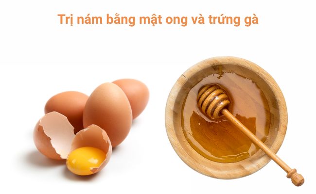 Cách trị nám bằng mật ong và trứng gà