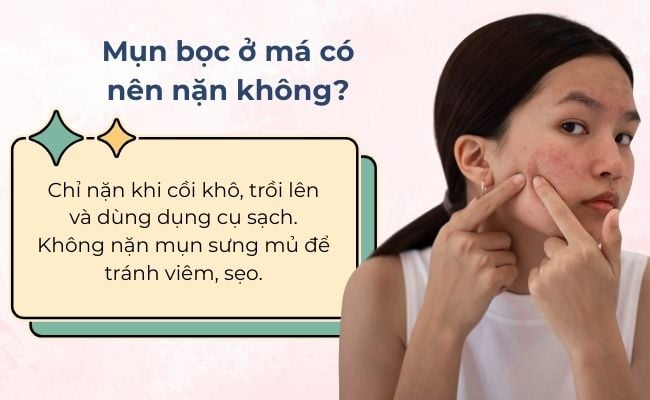 Mụn bọc ở má có nên nặn không?
