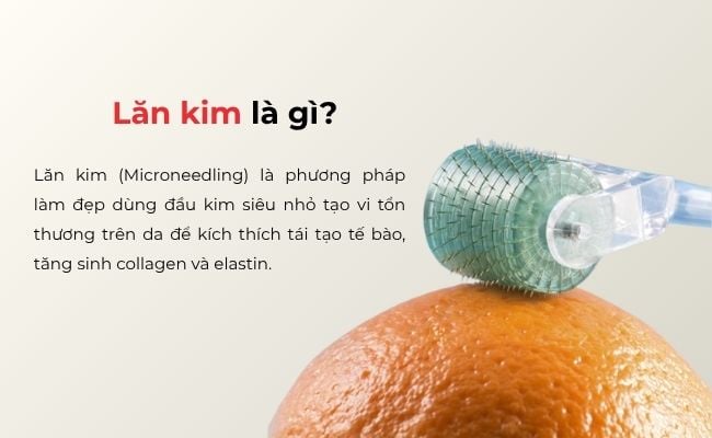 Lăn kim là gì? Tác động của lăn kim đối với làn da