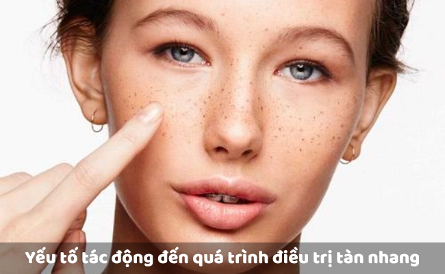 Yếu tố tác động đến quá trình điều trị tàn nhang