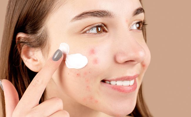 Tretinoin là gì?