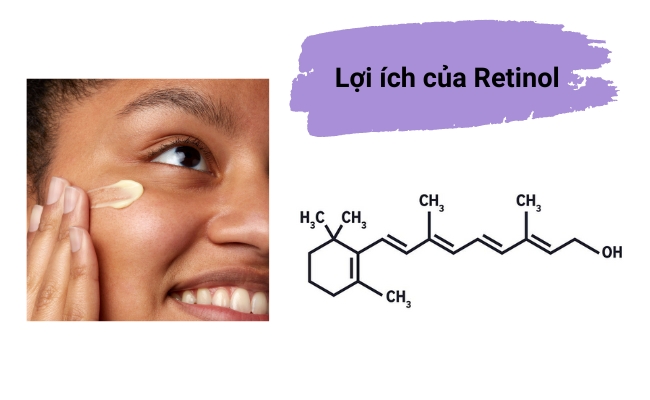 Retinol giúp cải thiện các vấn đề về da một cách hiệu quả và an toàn