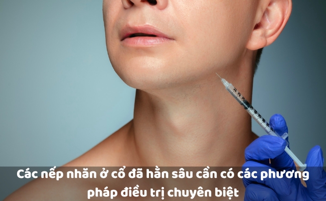 Cách xóa nếp nhăn ở cổ an toàn, đơn giản, hiệu quả nhất