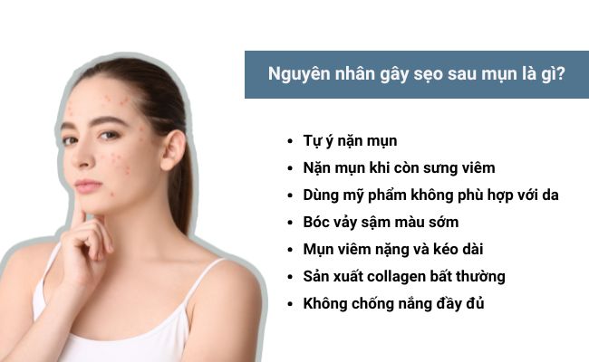 Nguyên nhân gây sẹo sau mụn là gì?