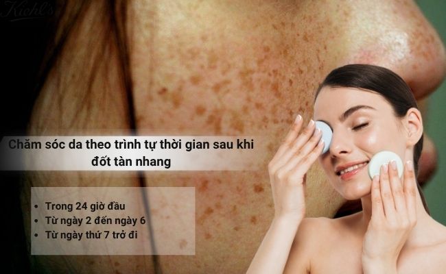 Chăm sóc da theo trình tự thời gian sau khi đốt tàn nhang