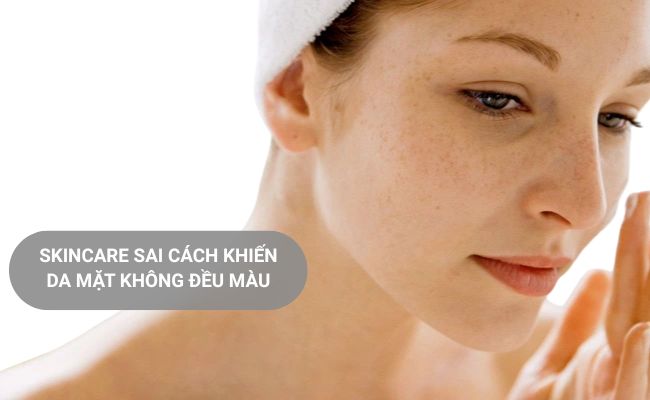 Da không đều màu do skincare sai cách