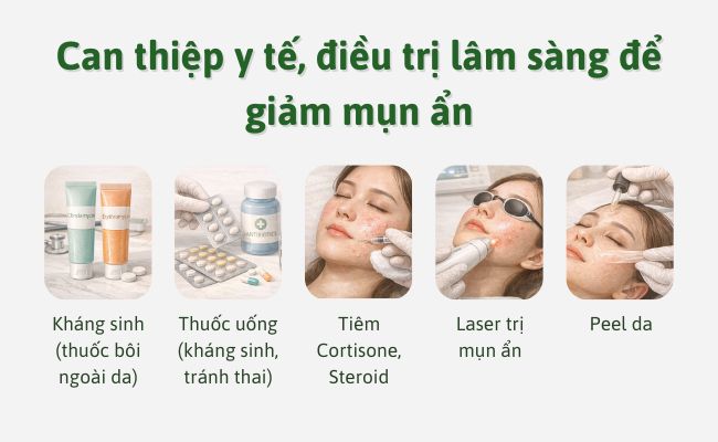 Can thiệp y tế, điều trị lâm sàng để giảm mụn ẩn