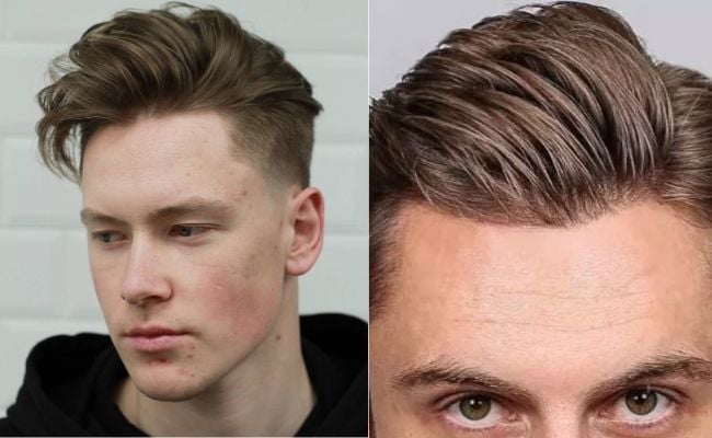 Kiểu tóc 7/3 cắt Undercut thu hút