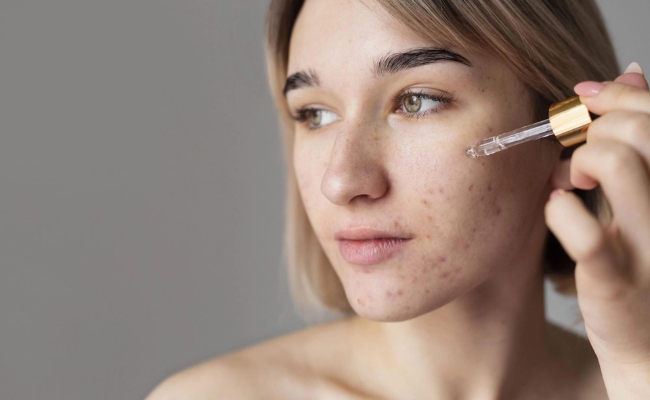 Liều lượng và nồng độ sử dụng salicylic phù hợp