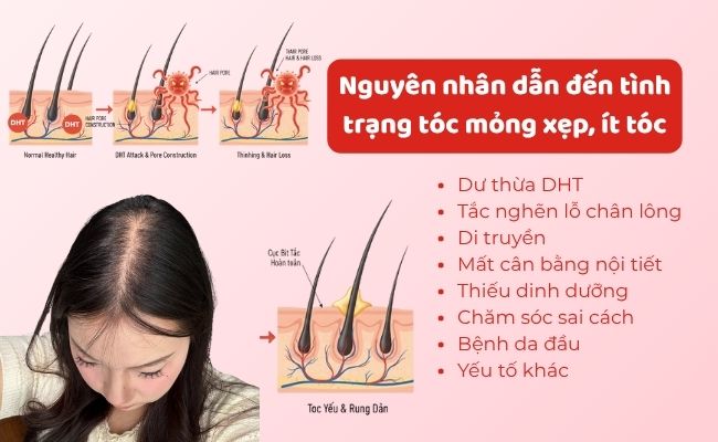 Nguyên nhân dẫn đến tình trạng tóc mỏng xẹp