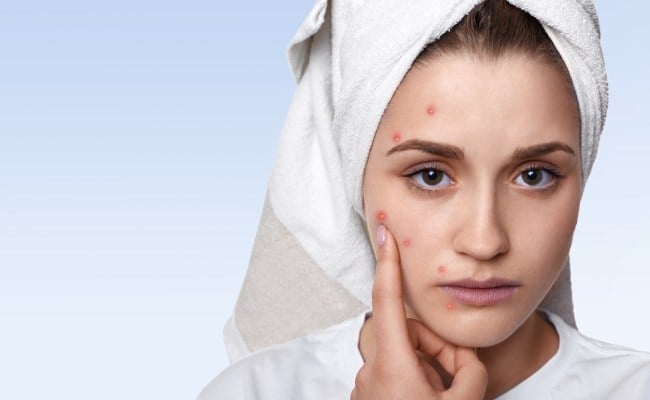 Mụn ở vị trí nào nguy hiểm nhất?