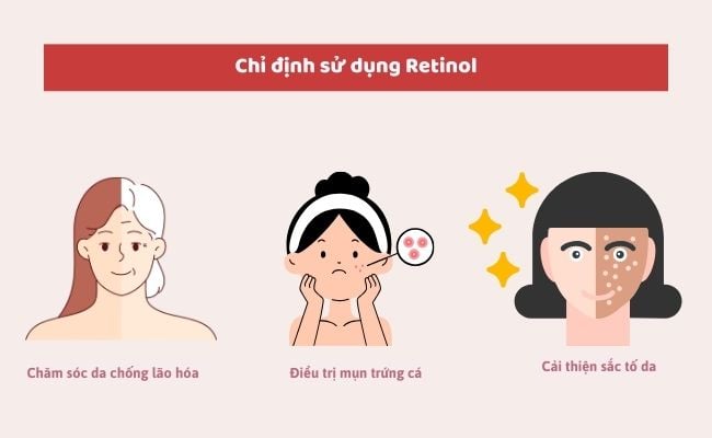 Trường hợp chỉ định sử dụng Retinol